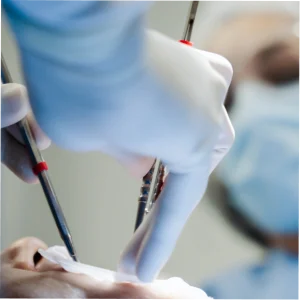 Post-operative advice