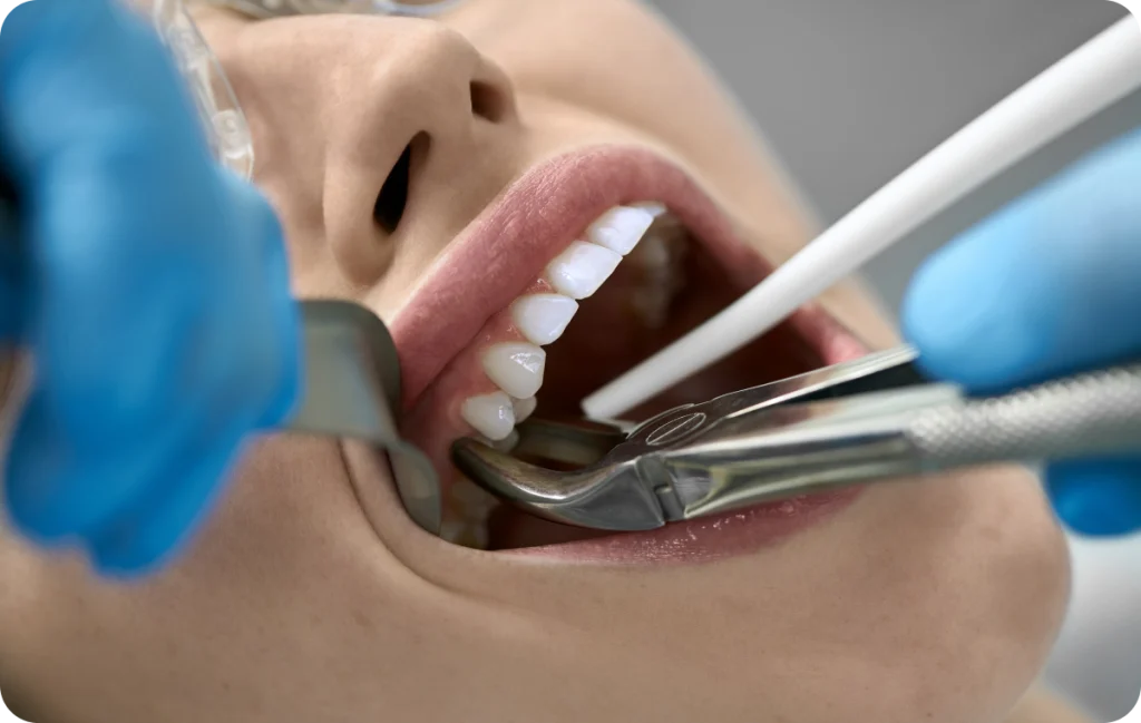 Immediate loading Dentistes à Cagnes-sur-Mer, Drs Payam & Pegah Gandjidadeh