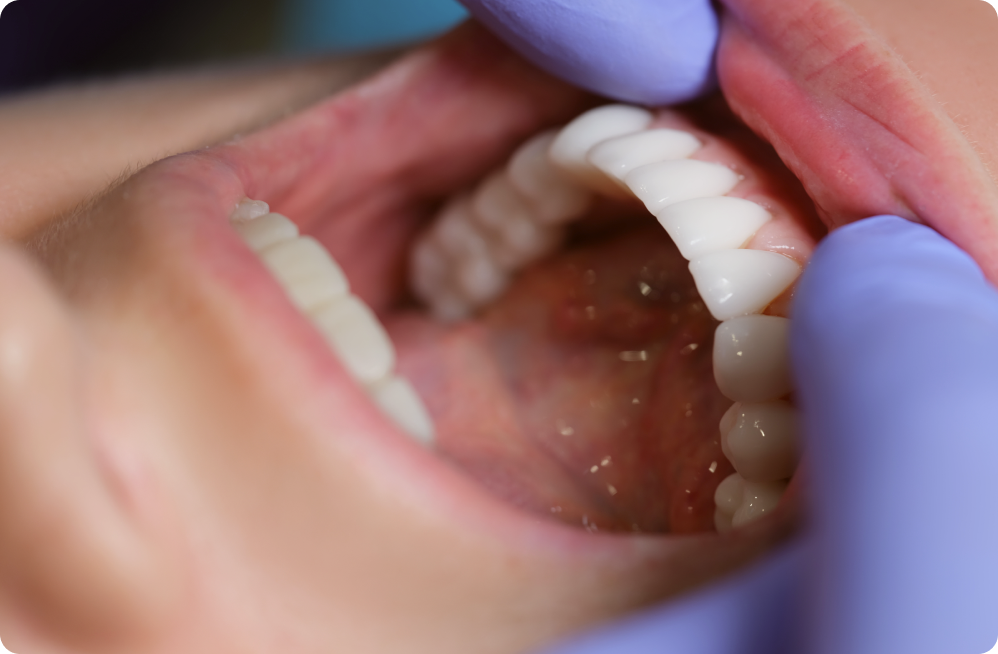 Your specific needs Dentistes à Cagnes-sur-Mer, Drs Payam & Pegah Gandjidadeh