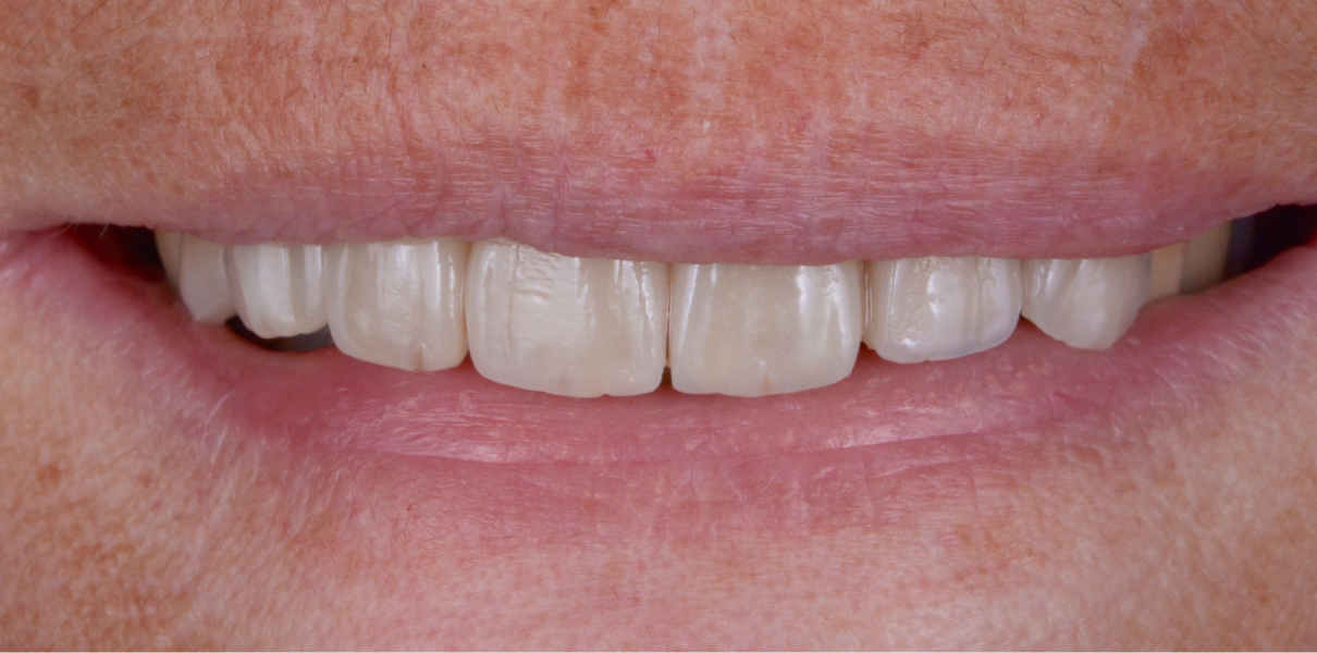 Clinical Cases Dentistes à Cagnes-sur-Mer, Drs Payam & Pegah Gandjidadeh