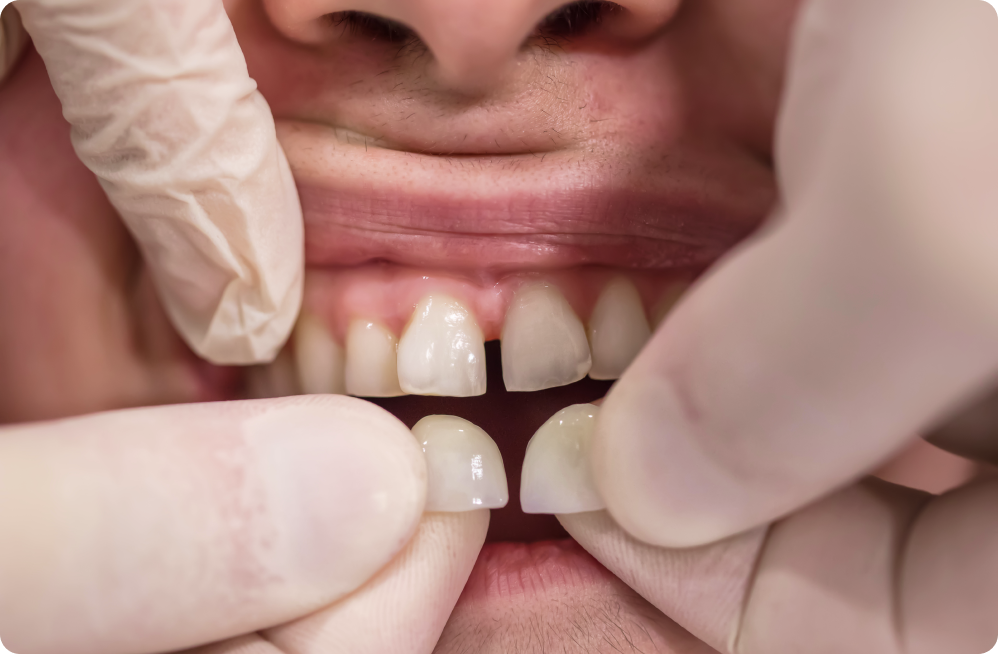 Your specific needs Dentistes à Cagnes-sur-Mer, Drs Payam & Pegah Gandjidadeh