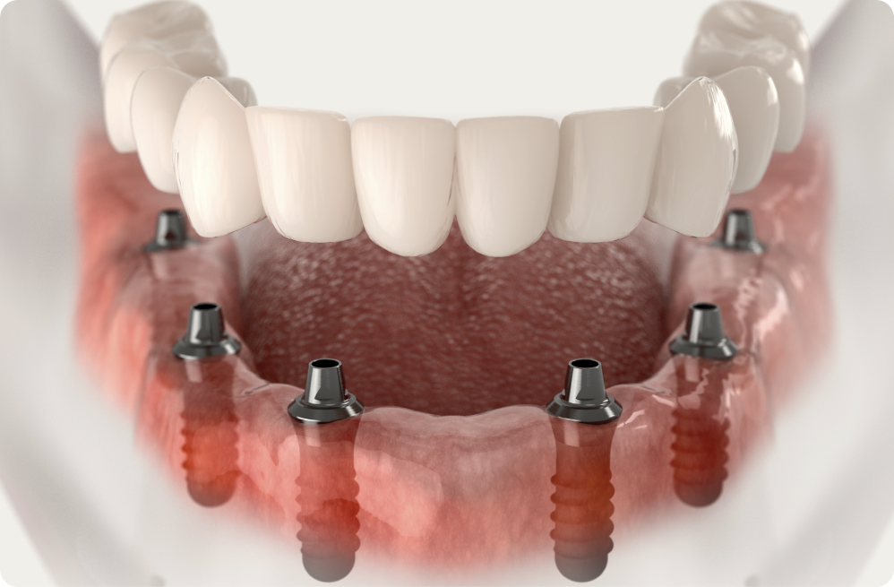 Your specific needs Dentistes à Cagnes-sur-Mer, Drs Payam & Pegah Gandjidadeh