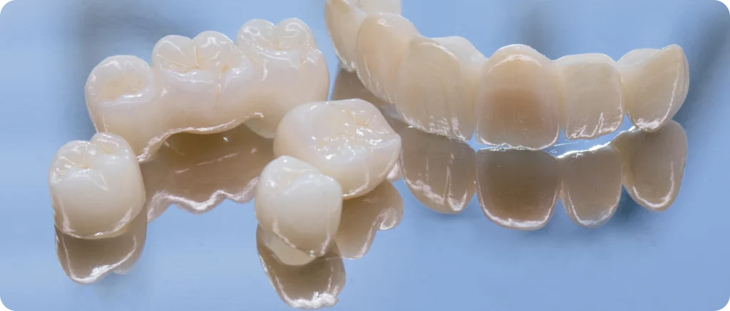 Crowns Dentistes à Cagnes-sur-Mer, Drs Payam & Pegah Gandjidadeh
