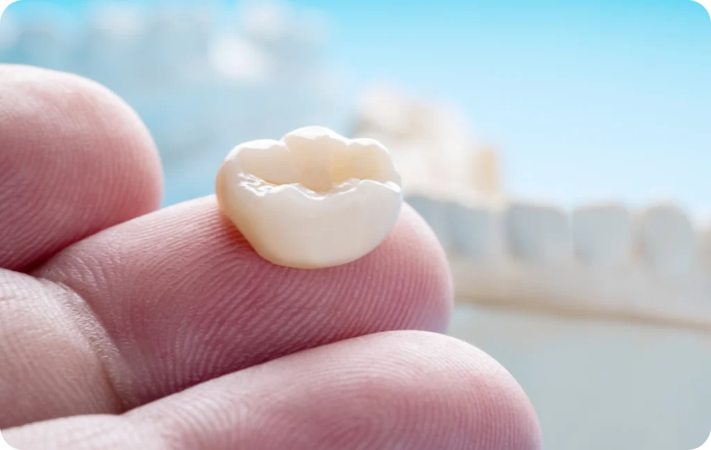 Crowns Dentistes à Cagnes-sur-Mer, Drs Payam & Pegah Gandjidadeh