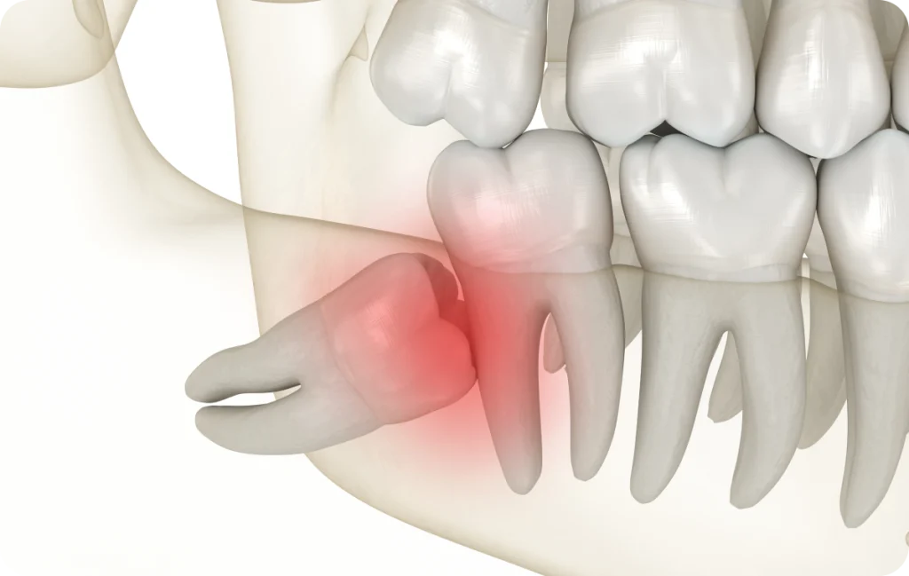 Wisdom Teeth Dentistes à Cagnes-sur-Mer, Drs Payam & Pegah Gandjidadeh