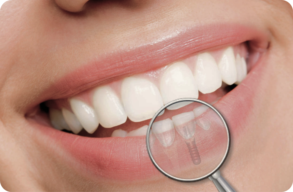 Your specific needs Dentistes à Cagnes-sur-Mer, Drs Payam & Pegah Gandjidadeh