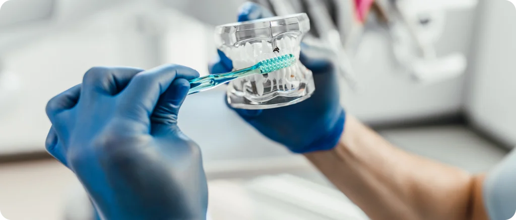Dental Veneer Dentistes à Cagnes-sur-Mer, Drs Payam & Pegah Gandjidadeh