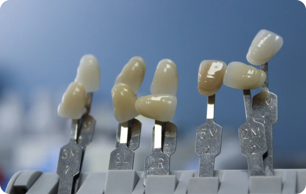 Dental Veneer Dentistes à Cagnes-sur-Mer, Drs Payam & Pegah Gandjidadeh