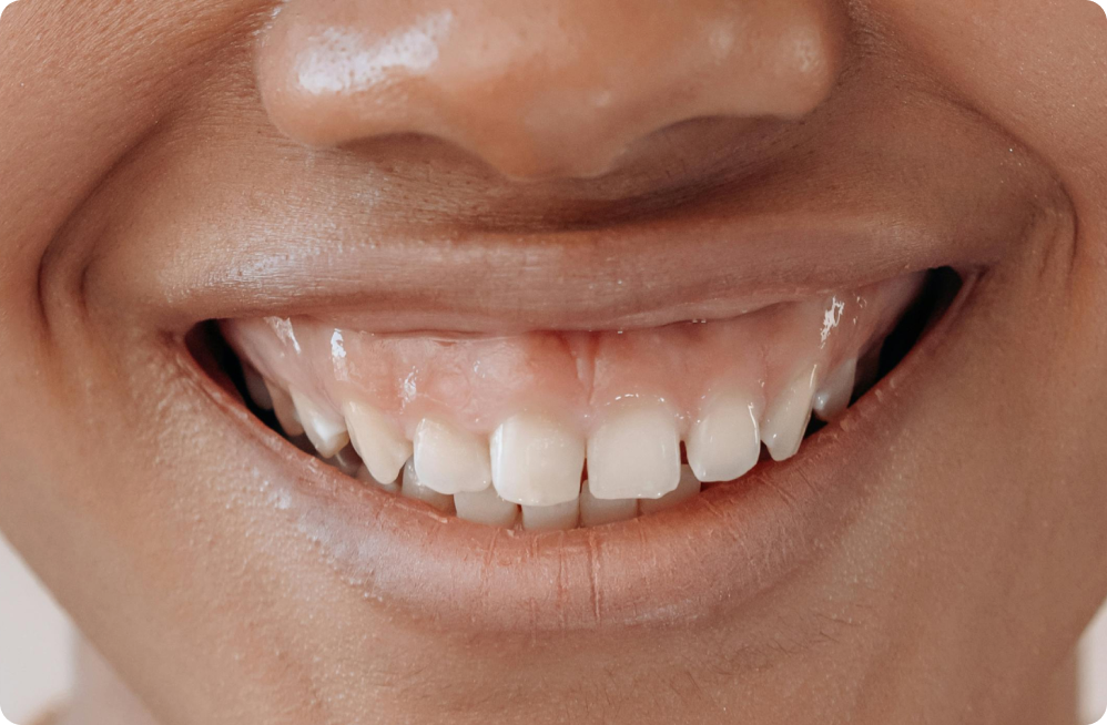 Your specific needs Dentistes à Cagnes-sur-Mer, Drs Payam & Pegah Gandjidadeh