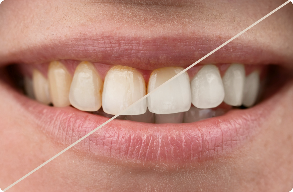 Your specific needs Dentistes à Cagnes-sur-Mer, Drs Payam & Pegah Gandjidadeh