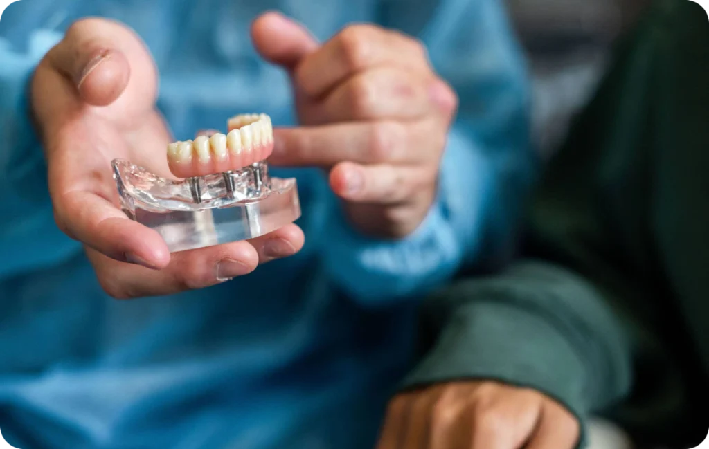 Removable Implant-Supported Denture Dentistes à Cagnes-sur-Mer, Drs Payam & Pegah Gandjidadeh