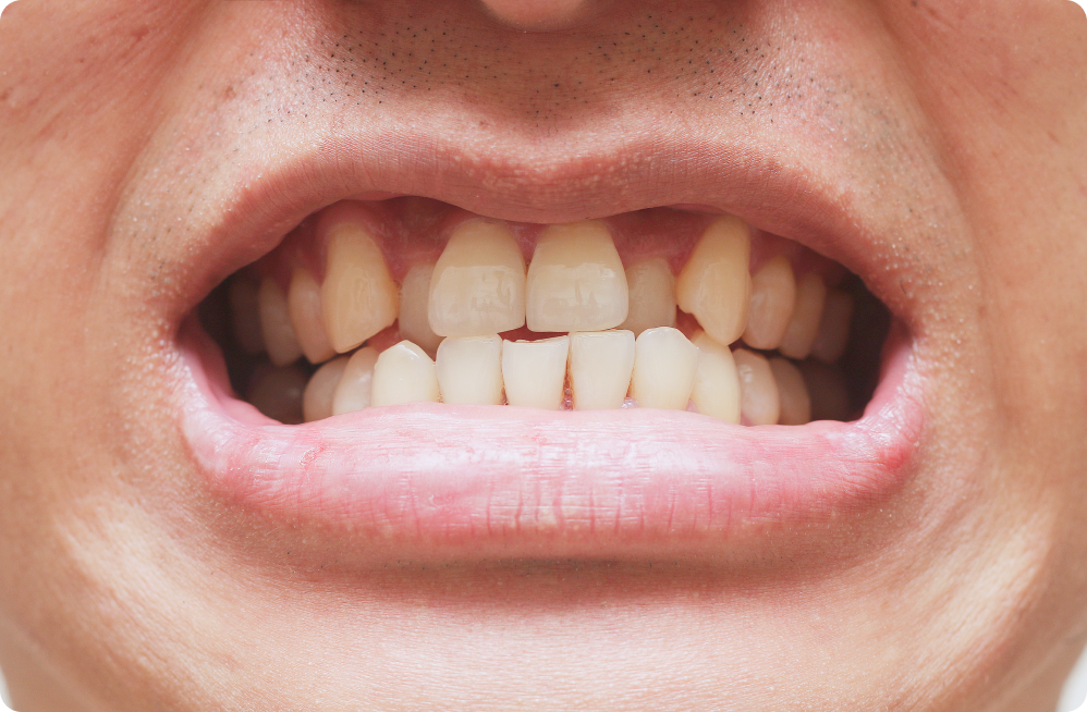 Your specific needs Dentistes à Cagnes-sur-Mer, Drs Payam & Pegah Gandjidadeh