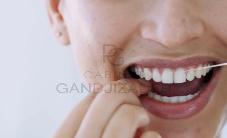 Dental flossing