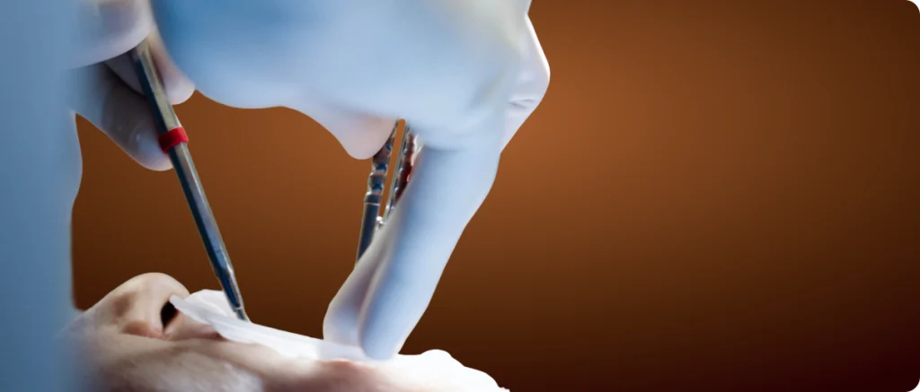 Soins sous anesthésie générale